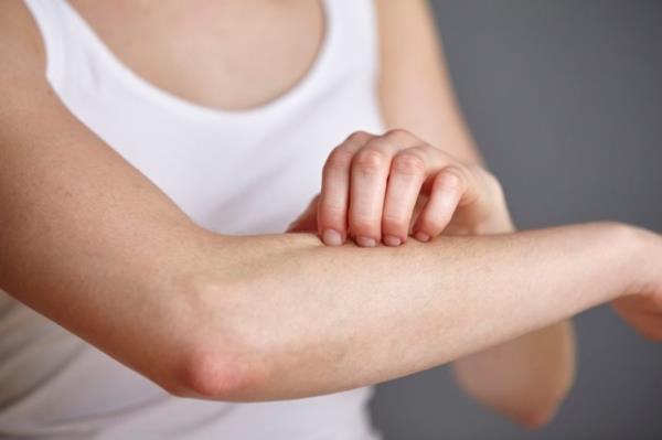 Co pomaga w walce z objawami swędzenia skóry