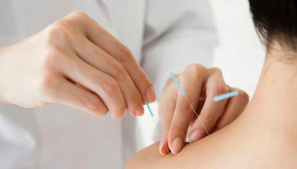 acupuncture contre l'allergie à l'ambroisie